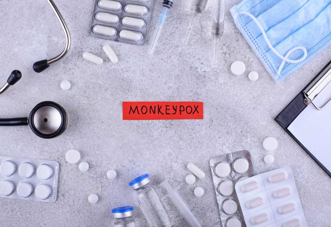 Monkeypox – Prevention Steps!